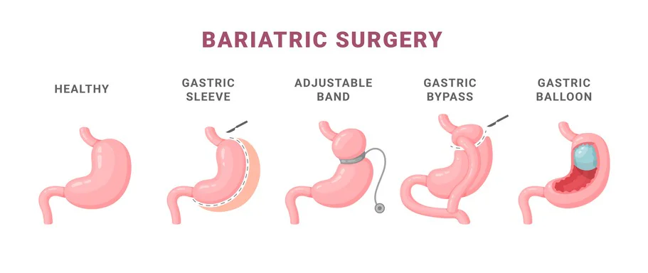 2. Ter um médico que prepare seu corpo para a cirurgia
